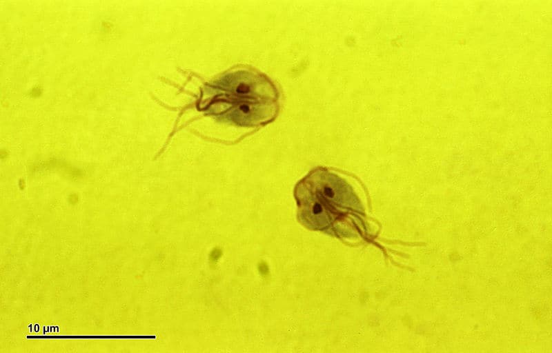 Giardia under a microscope. Image courtesy Doc. RNDr. Josef Reischig, CSc 