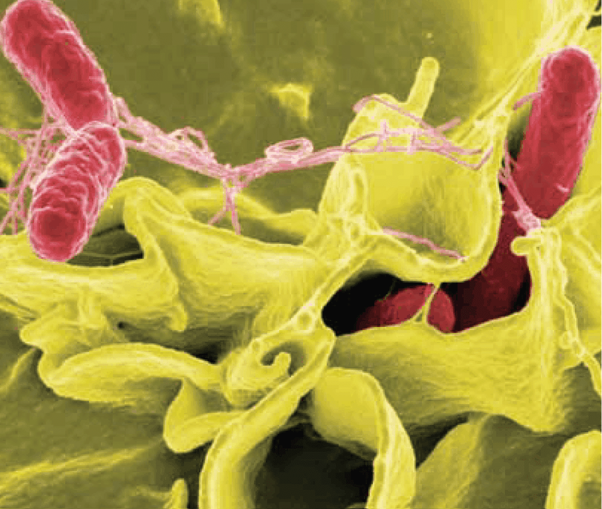 Colour-enhanced scanning electron micrograph showing Salmonella typhimurium (red) invading cultured human cells Credit: Rocky Mountain Laboratories, NIAID, NIH