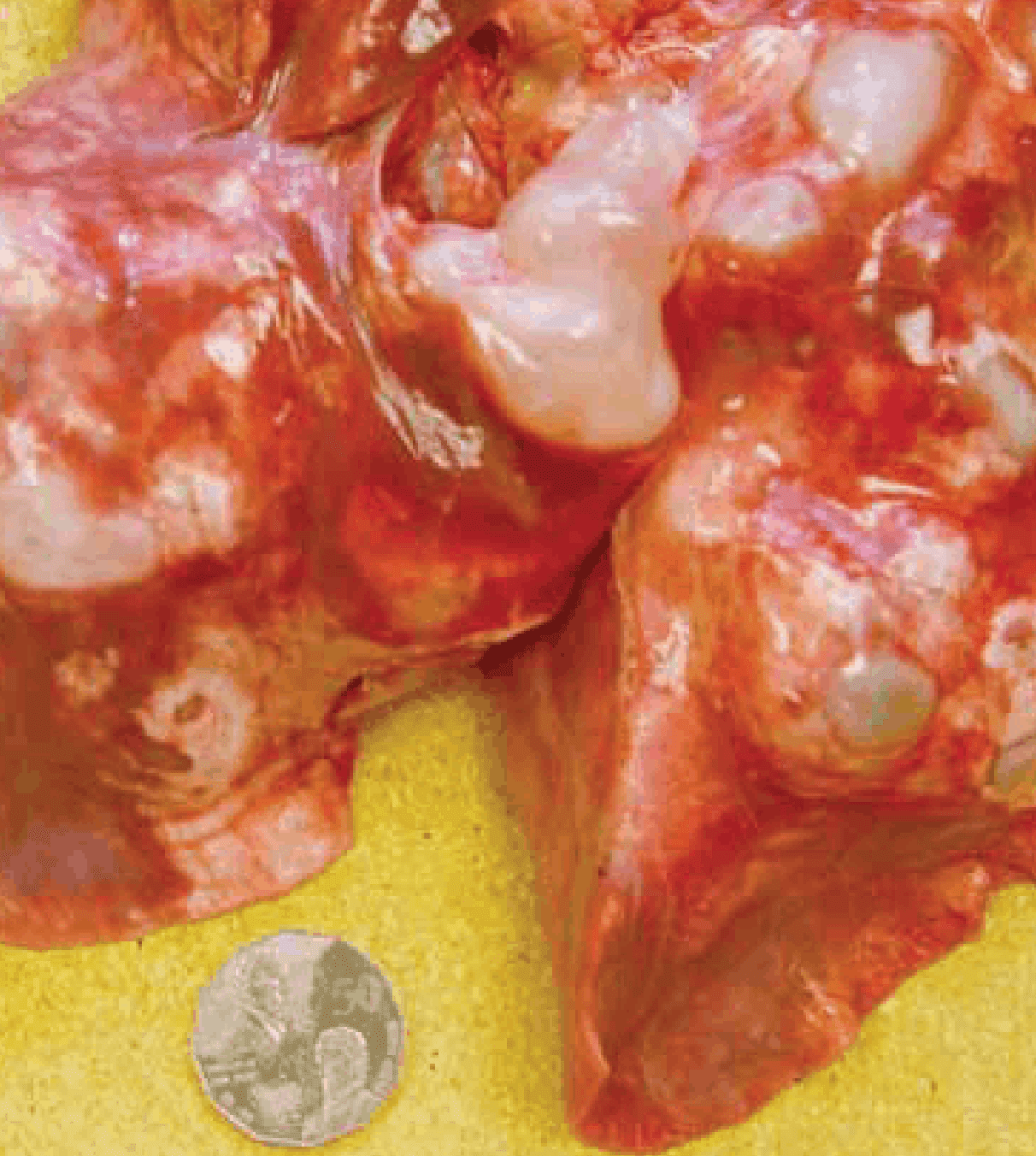 Hydatid cysts in a cow’s lung: if you find cysts like this in animals phone your vet. Photo courtesy: David Jenkins 