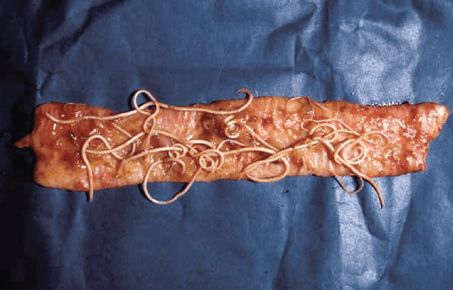 Dog Roundworm in dog gut. 
Photo courtesy of Nick Sangster, University of Sydney width=