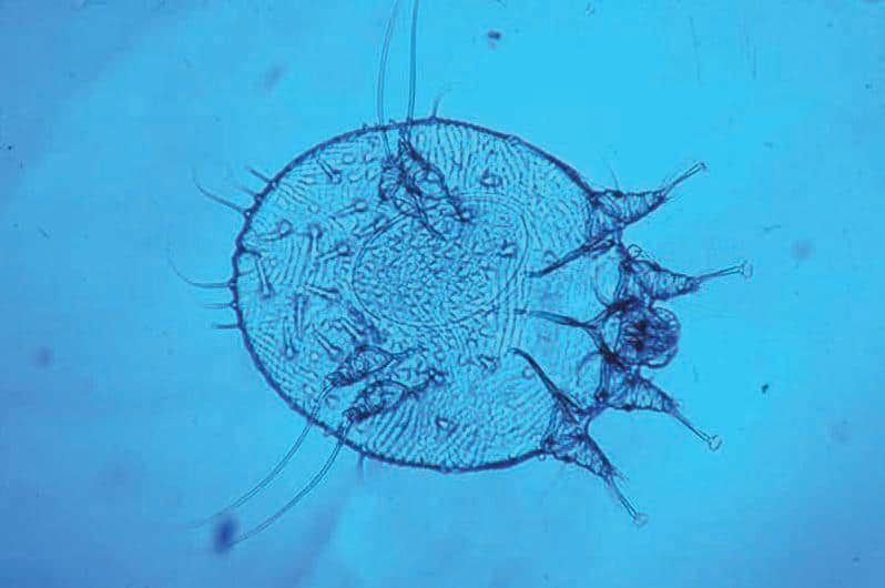 Scabies mite seen under a microscope. Image courtesy Graeme Brown width=