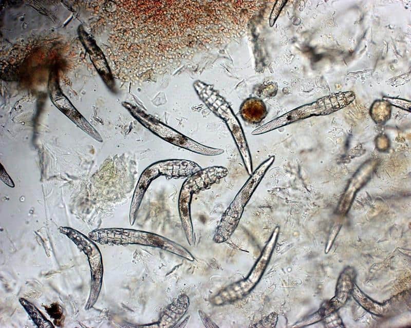Demodex mites seen under a microscope. Image courtesy Graeme Brown width=