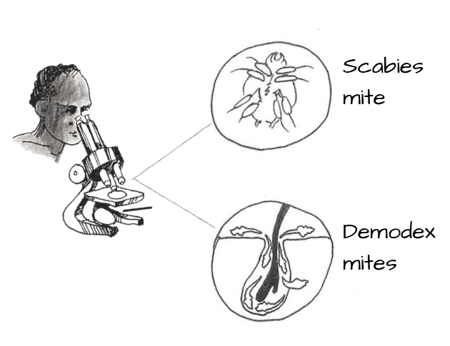 man looking at mites in microscope